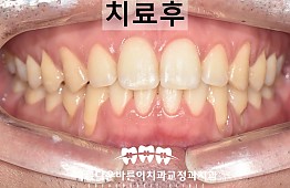 수술후