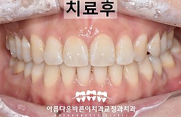 수술후