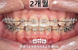 수술후