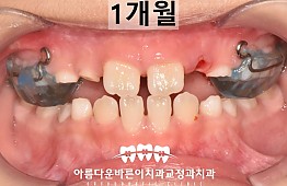 수술후