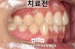 수술전