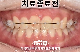 수술후