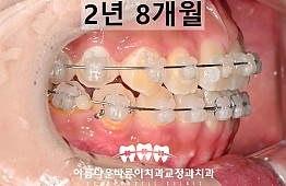 수술후
