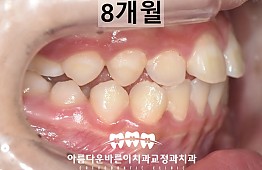 수술후