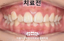 수술전