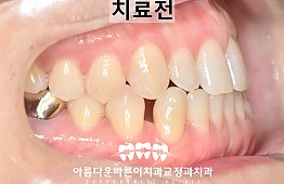 수술전