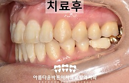 수술후