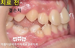 수술전