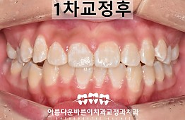 수술후