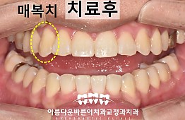 수술후