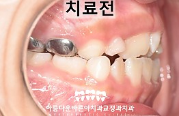수술전