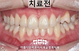 수술전