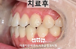 수술후