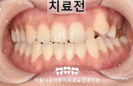 수술전