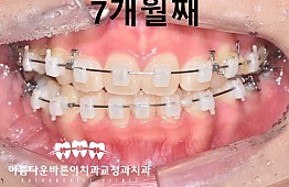 수술후