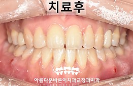 수술후