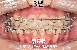 수술후