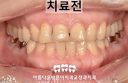 수술전