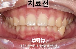 수술전