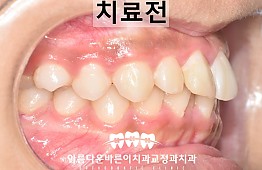 수술전