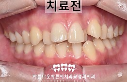 수술전