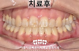 수술후