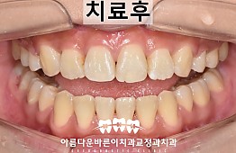 수술후