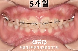 수술후