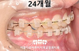 수술후