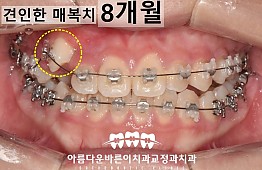 수술후