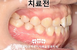 수술전