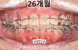 수술후