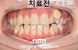 수술전