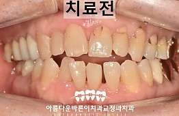 수술전