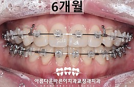 수술후