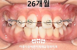 수술후