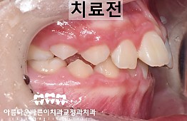 수술전