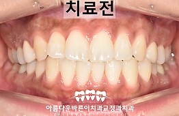 수술전