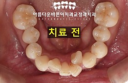 수술전