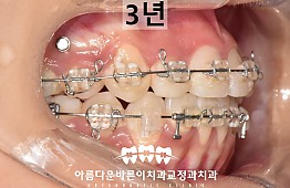 수술후