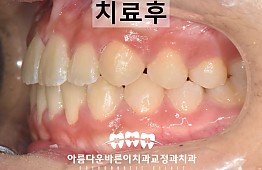 수술후