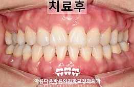 수술후