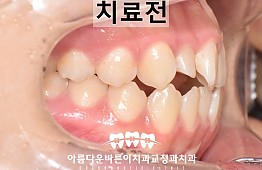 수술전