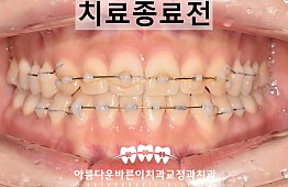 수술후