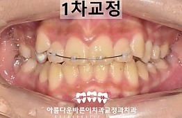 수술후