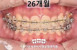 수술후