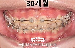 수술후