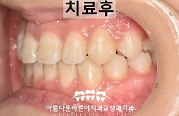 수술후