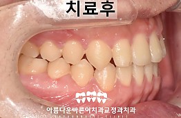 수술후