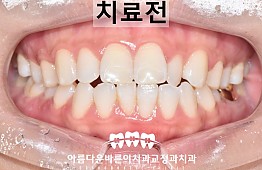 수술전